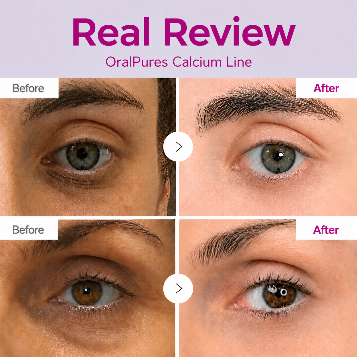 EyeRevive – Calcium Eye Restoration Cream