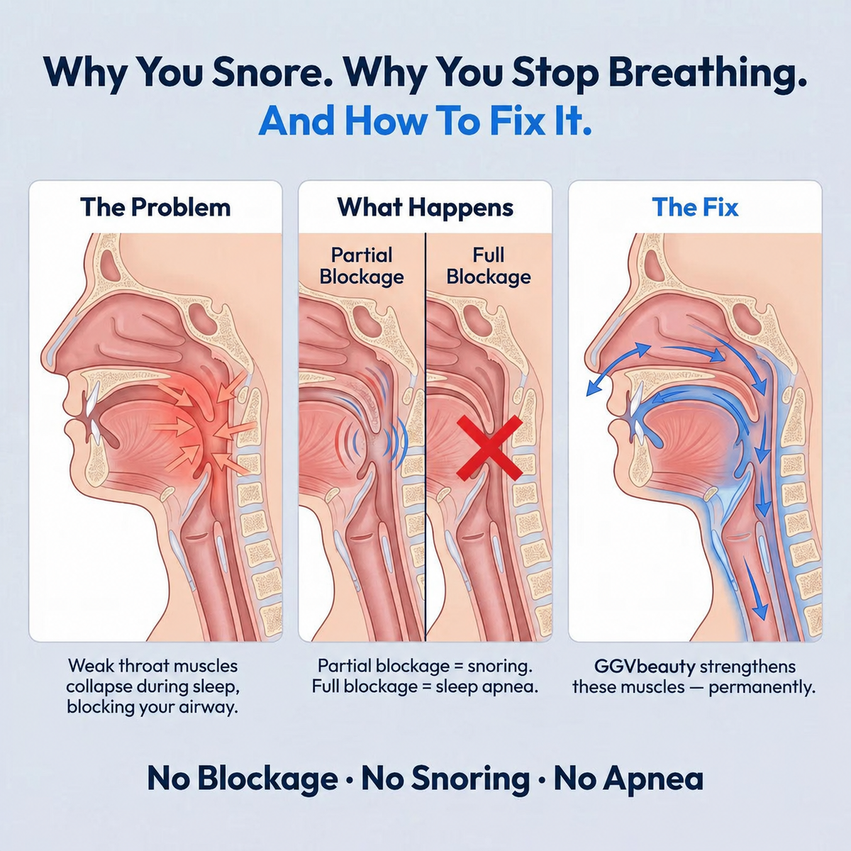SleepTone – Throat Muscle Conditioning Sleep Device