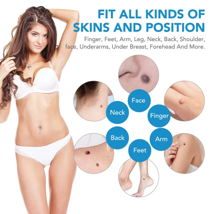 SkinRelief – Skin Tag Removal Ring Set
