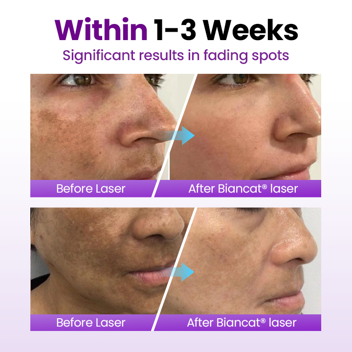 SpotNova – Probiotic Dark Spot Corrector