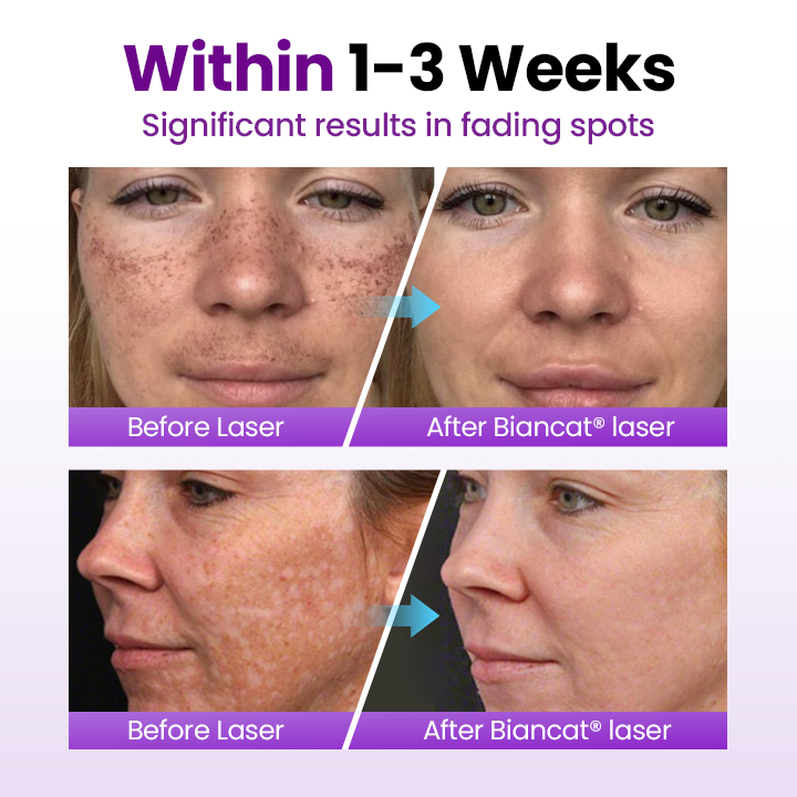 SpotNova – Probiotic Dark Spot Corrector
