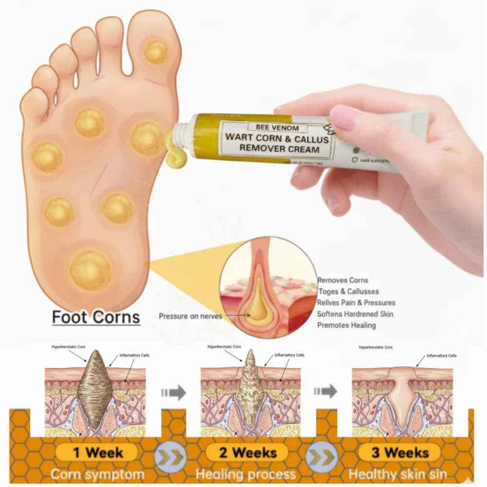 SoleRevive – Advanced Foot Skin Renewal Formula