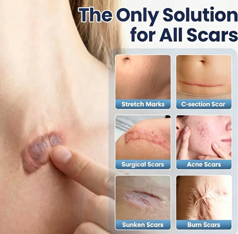 ClearDerm – Scar Recovery Cream