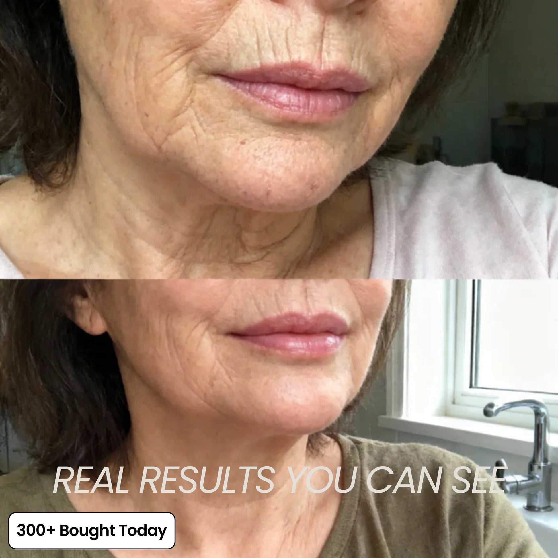 LuminaLift – Wrinkle & Hollow Eye Balm