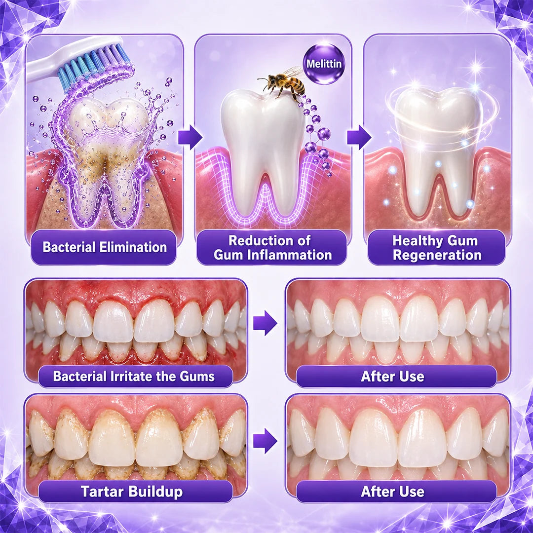 GumVanta - Bee Venom Oral Care Toothpaste