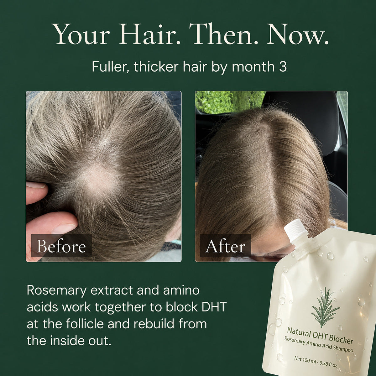 RosemaryBloom – Strengthening Scalp Care Shampoo