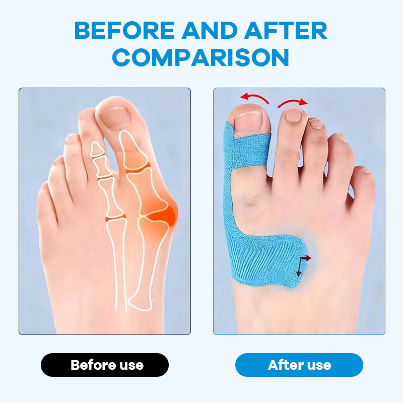 BunionShield – Flexible Toe Support Tape