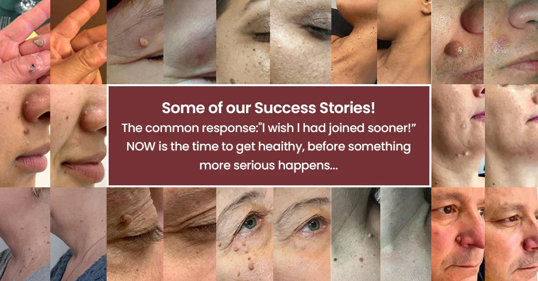 DermaRenew – Microneedle Skin Repair Patch