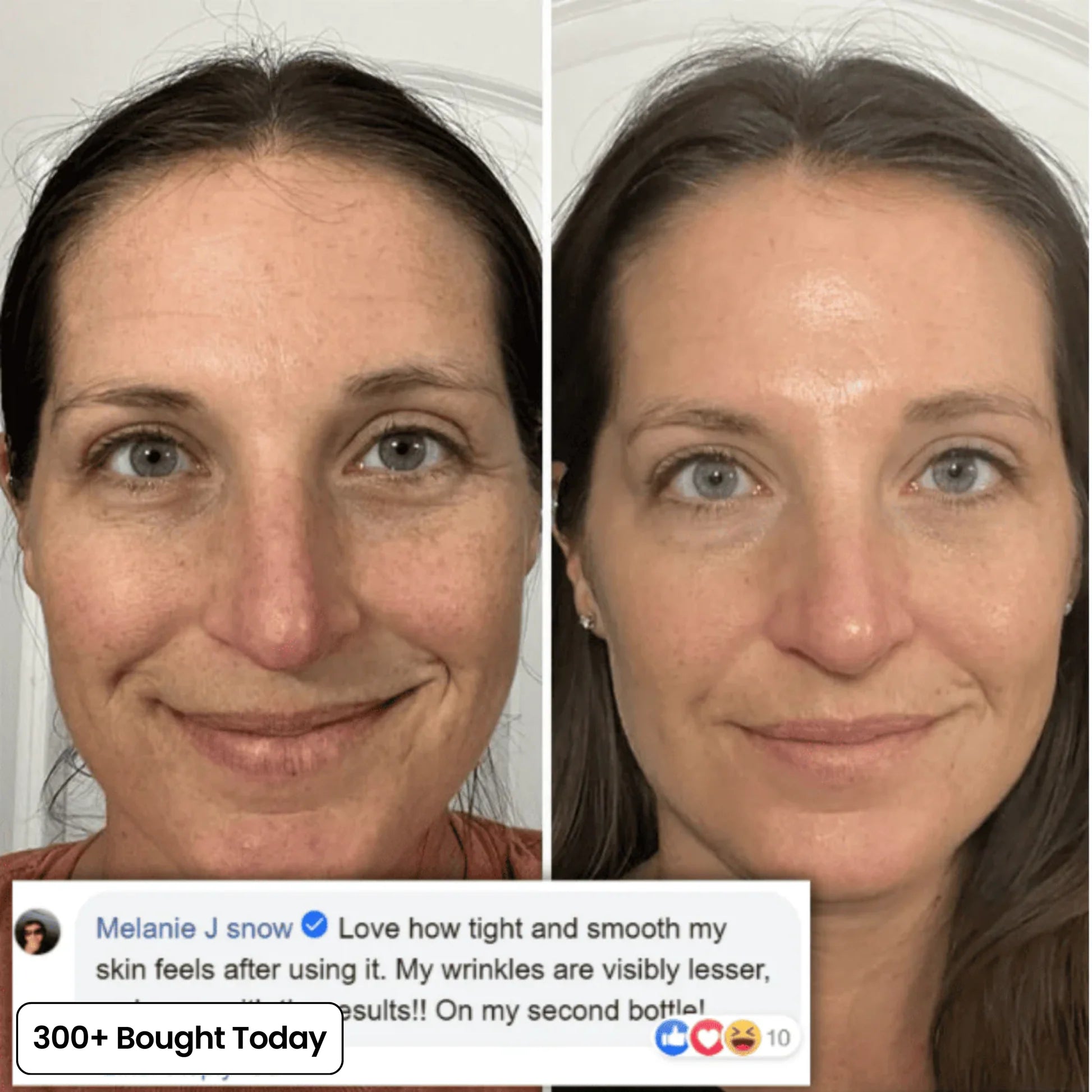 LuminaLift – Wrinkle & Hollow Eye Balm