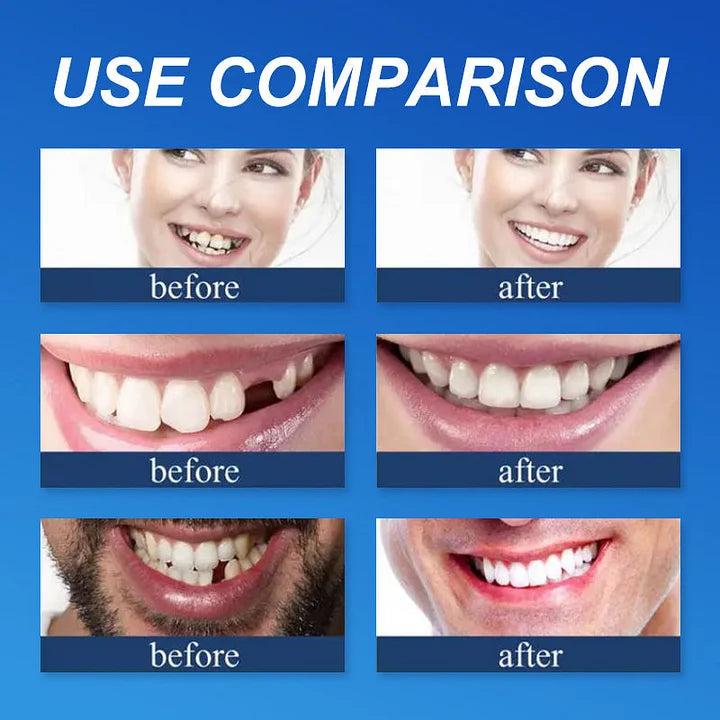 SmileRevive - Everyday Confidence Denture