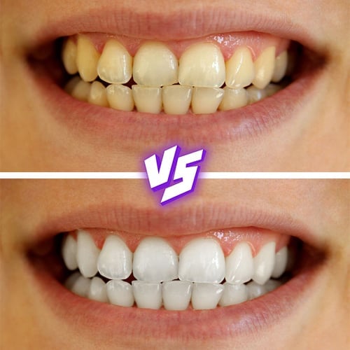 SmileBreeze – Refreshing Everyday Toothpaste