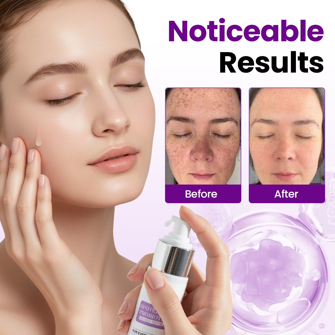 SpotNova – Probiotic Dark Spot Corrector