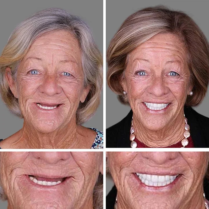 SmileRevive - Everyday Confidence Denture