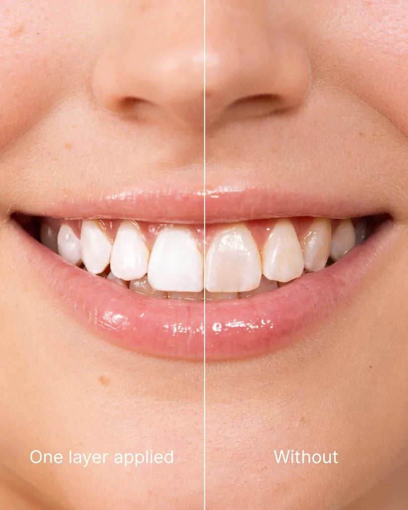 GlowSmile – Instant Whitening Polish