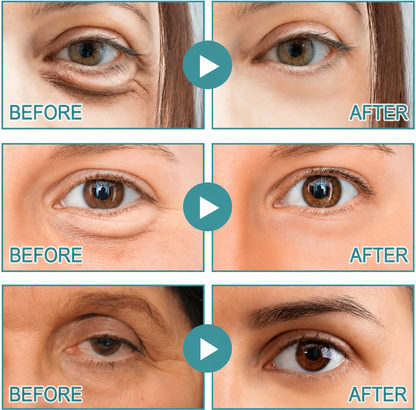BrightLift – Overnight Eye Renewal Patches