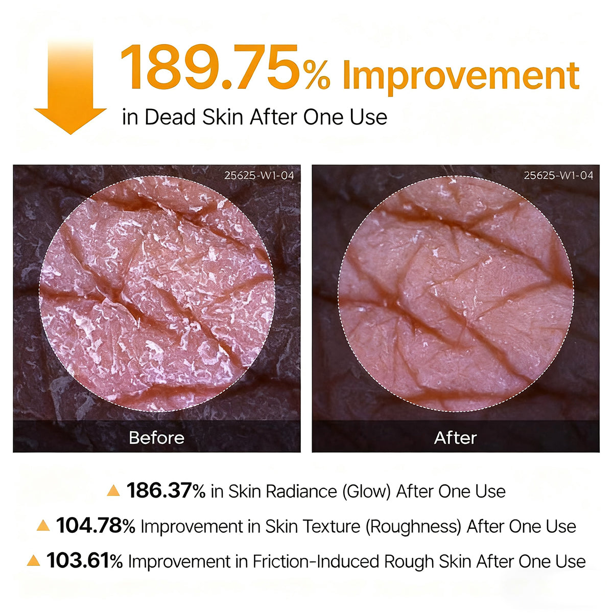 GlowPeel – Keratin Care Kojic Acid Turmeric Body Peeling Spray