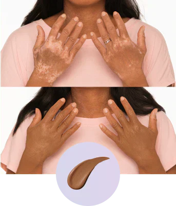 SkinVeil – Flawless Body Coverage Perfector SPF 30