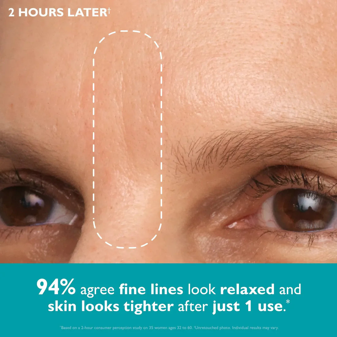 GlowSleep – Overnight Smoothing Patches