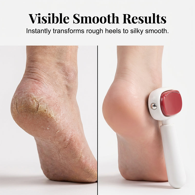 SoleVera – Double-Sided Stainless Steel Foot Scraper