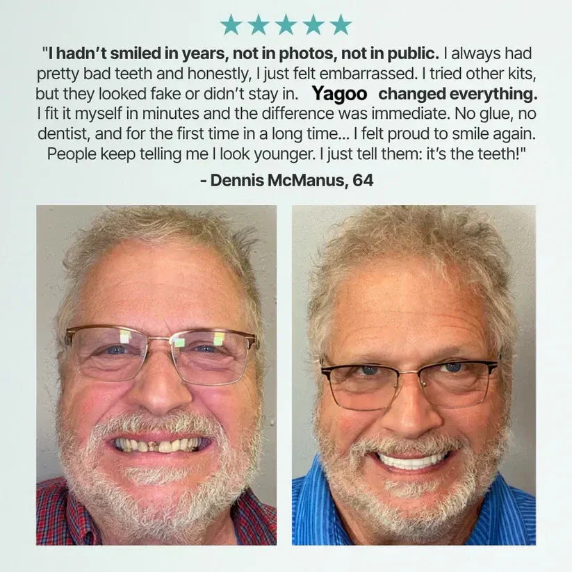 SmileRevive - Everyday Confidence Denture