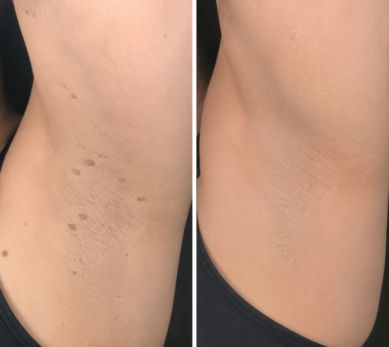 DermaRenew – Microneedle Skin Repair Patch