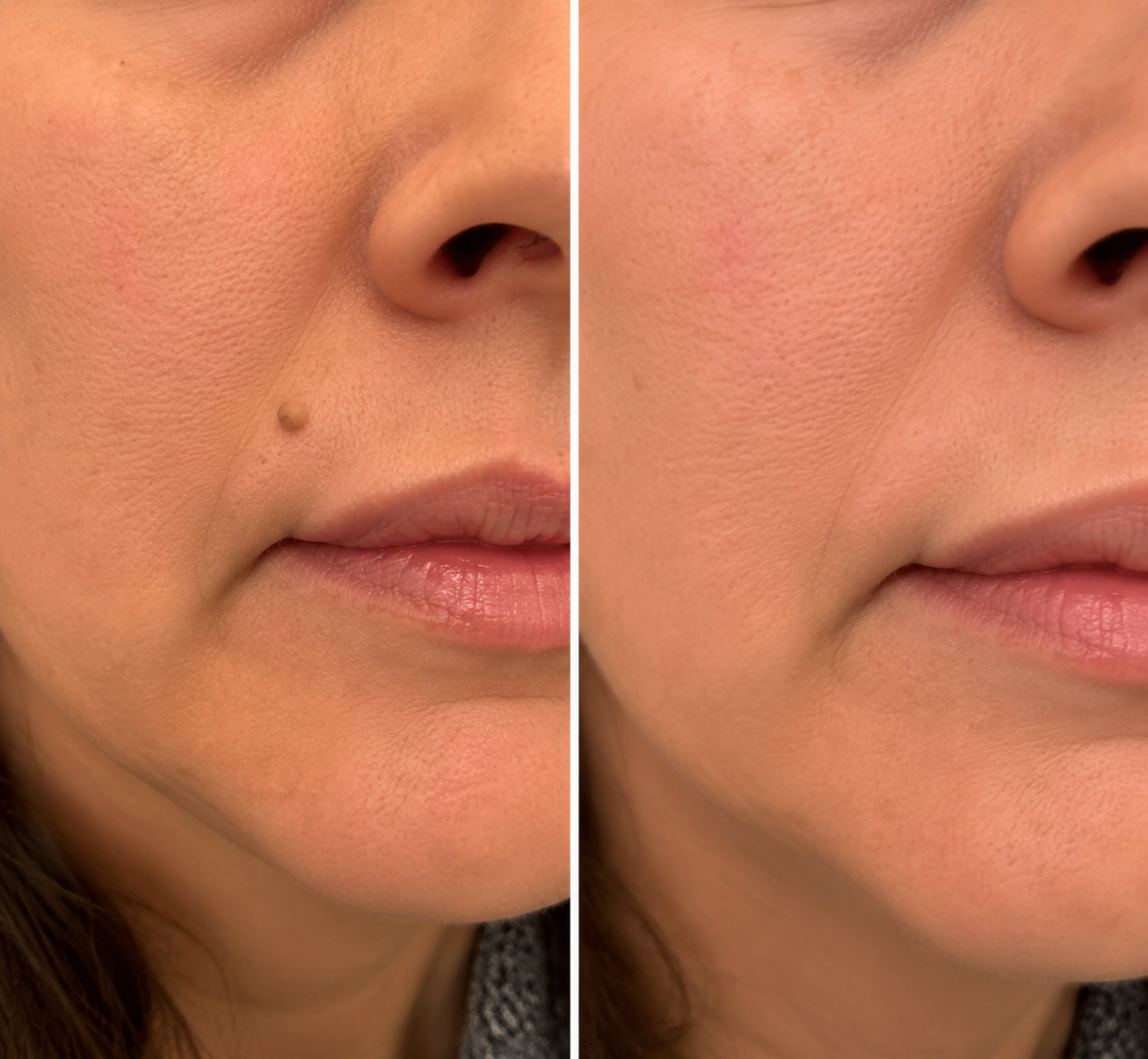 DermaRenew – Microneedle Skin Repair Patch