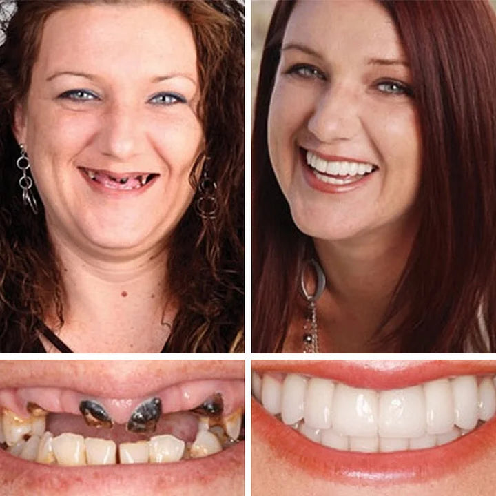 SmileRevive - Everyday Confidence Denture