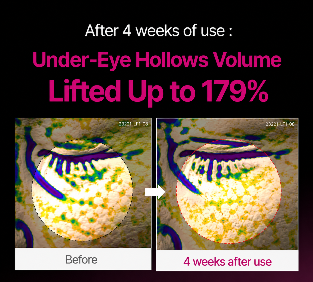 EyeRevive – Calcium Eye Restoration Cream