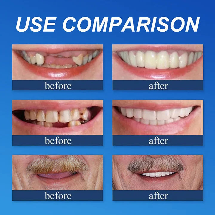 SmileRevive - Everyday Confidence Denture