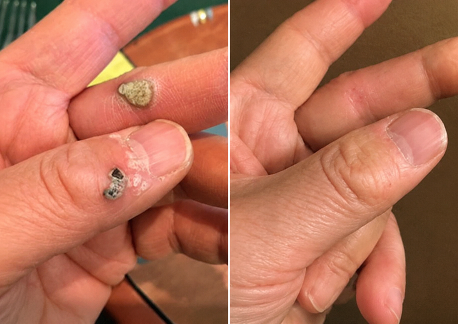 DermaRenew – Microneedle Skin Repair Patch