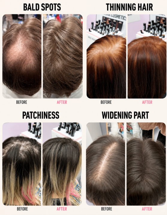 LushLocks – Remy Human Hair Volume Extensions