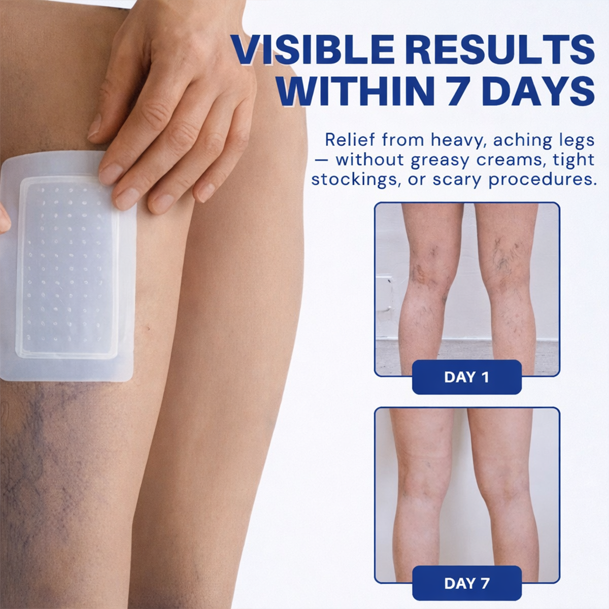 VenoLume – Diosmin & Hesperidin Microneedle Vein Patch