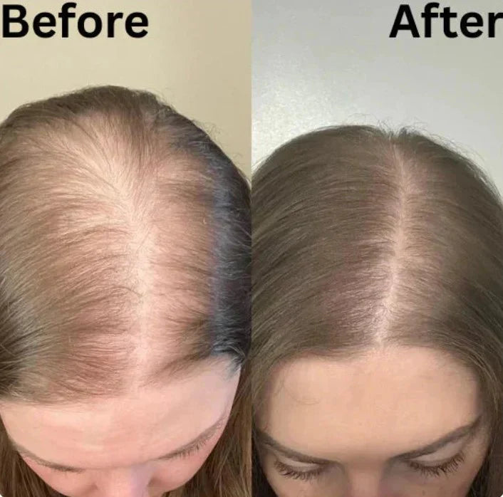 RosemaryBloom – Strengthening Scalp Care Shampoo