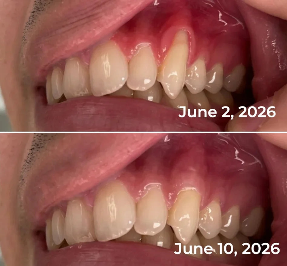 GumVanta - Bee Venom Oral Care Toothpaste
