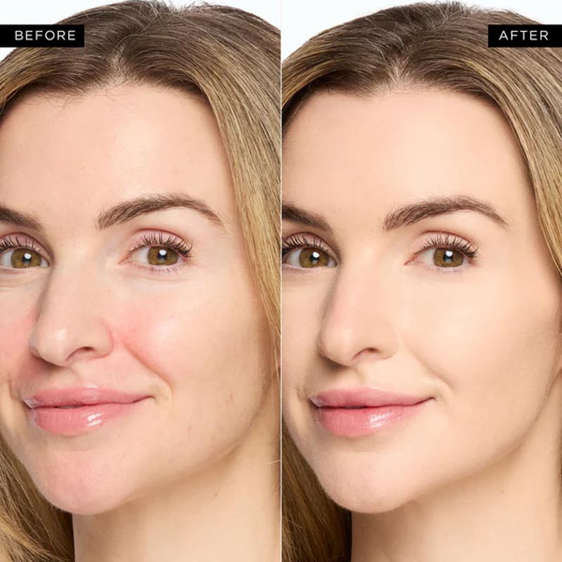 EyeRadiance – Full Coverage Concealer